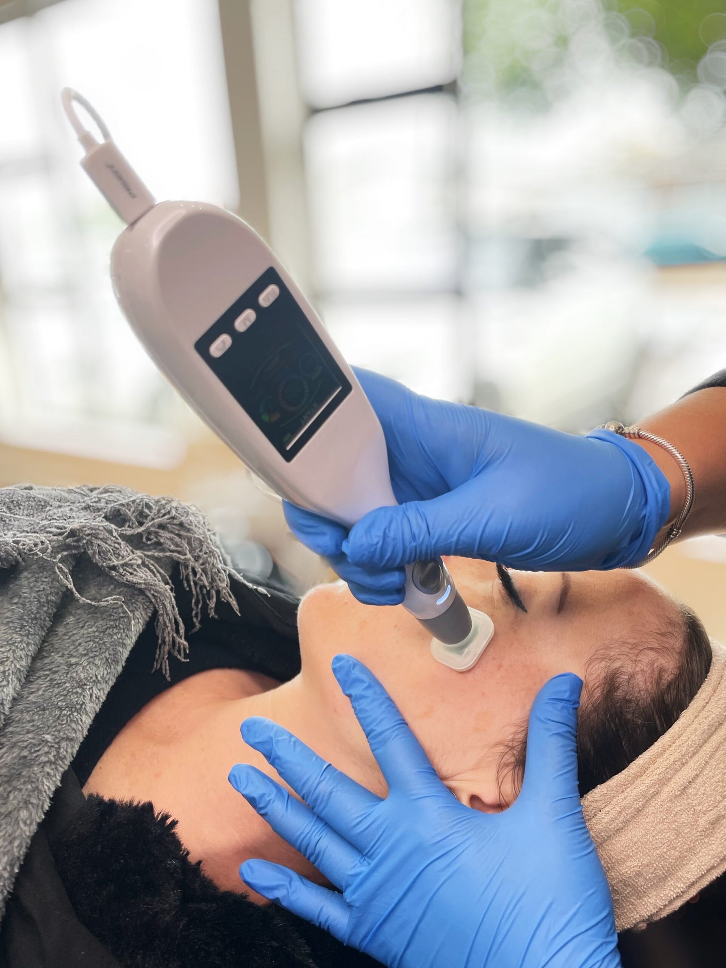 Profosma Jet Plasma 1 Cycle (3 Treatments)